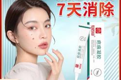 赤峰紅山區(qū)點痣店電話號碼