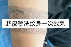 赤峰超皮秒紋身店地址電話號碼