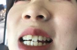 赤峰市招聘美牙師傅電話號碼