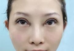 赤峰錦然雙眼皮店電話號碼