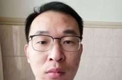 赤峰劉鳳波醫(yī)生電話號碼是多少