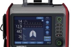 赤峰出租呼吸機(jī)電話多少號(hào)