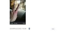 赤峰假手指定制店電話地址查詢