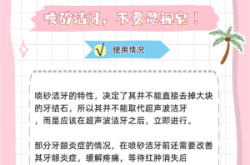 赤峰洗牙噴砂價(jià)格查詢電話號(hào)碼