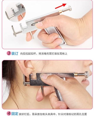 赤峰穿刺耳洞醫(yī)院地址電話號碼-第1張圖片