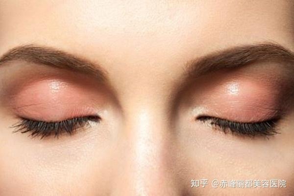 赤峰市雙眼皮醫(yī)院電話號(hào)碼-第1張圖片