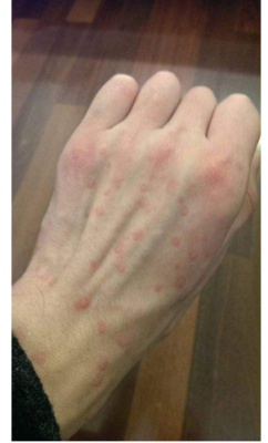 赤峰市醫(yī)院性病熱線電話號碼-第1張圖片