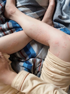 赤峰市林東安定醫(yī)院電話號(hào)碼-第1張圖片