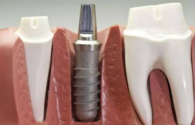 赤峰新城區(qū)口腔醫(yī)院電話號(hào)碼-第1張圖片