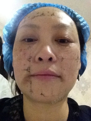 赤峰元辰醫(yī)美醫(yī)院電話地址查詢-第1張圖片