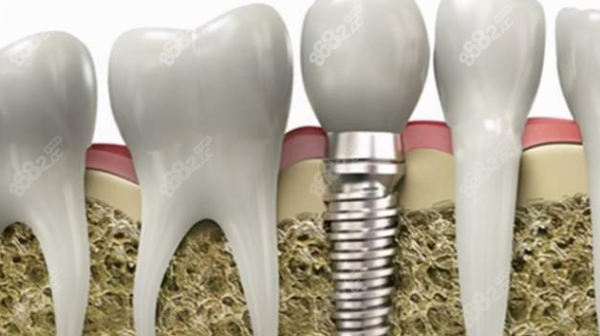 內(nèi)蒙赤峰口腔診所電話號(hào)碼多少-第1張圖片