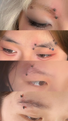 赤峰眉釘穿孔醫(yī)院電話是多少號(hào)-第1張圖片