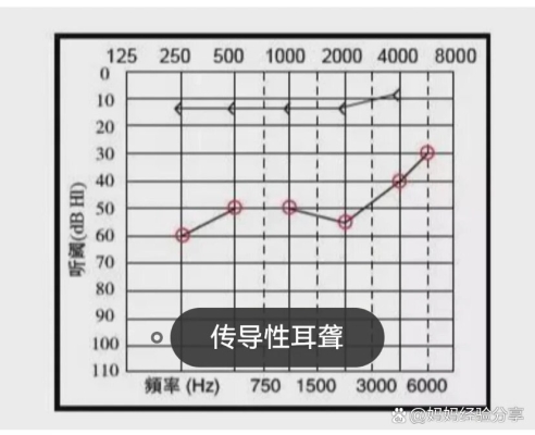 赤峰市耳朵聽力檢測機(jī)構(gòu)電話號碼-第1張圖片
