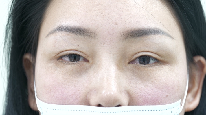 赤峰做雙眼皮醫(yī)院簡(jiǎn)介電話號(hào)碼-第1張圖片