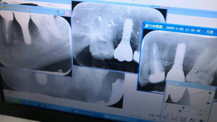 赤峰錦美口腔連鎖電話多少號-第1張圖片