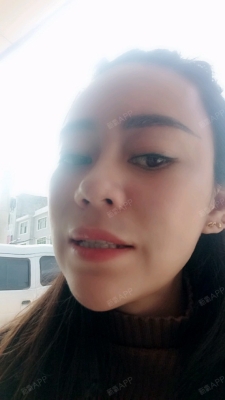 赤峰市冷光美白地址電話號碼-第1張圖片