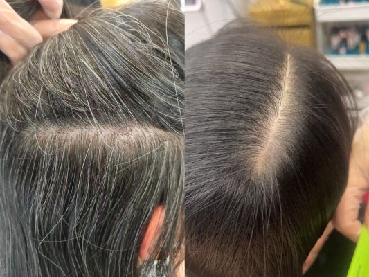 赤峰旺香婷養(yǎng)發(fā)師電話號碼-第1張圖片