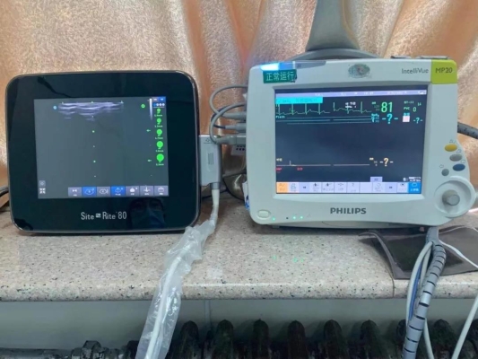 赤峰數(shù)碼印刷機(jī)電話多少號(hào)-第1張圖片