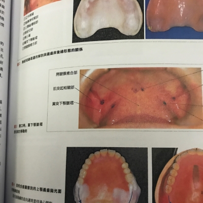 赤峰精翼義齒加工廠電話號(hào)碼-第1張圖片