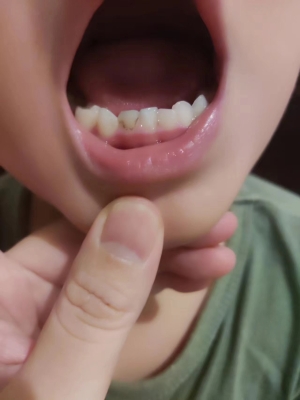 赤峰優(yōu)貝口腔醫(yī)院電話地址查詢-第1張圖片