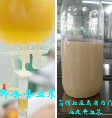 赤峰市醫(yī)院血漿機(jī)采購(gòu)電話(huà)號(hào)碼-第1張圖片