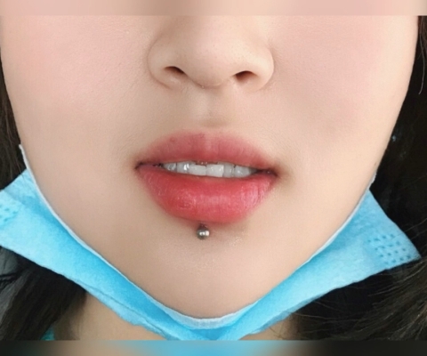 赤峰眉釘穿孔醫(yī)生電話號(hào)碼是多少-第1張圖片