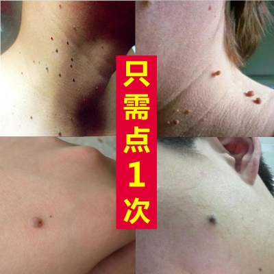 赤峰無痕修復(fù)旗艦店電話號碼-第1張圖片