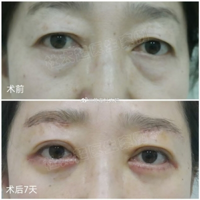 赤峰切眉美容院電話地址查詢-第1張圖片