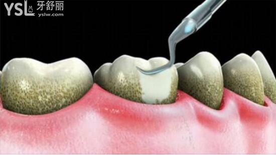 赤峰市潔美口腔門(mén)診電話(huà)號(hào)碼-第1張圖片