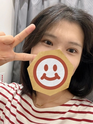 赤峰雙眼皮手術(shù)團(tuán)購(gòu)電話號(hào)碼-第1張圖片