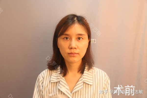 赤峰市醫(yī)院面診師電話號(hào)碼-第1張圖片