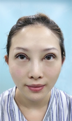 赤峰錦然雙眼皮店電話號(hào)碼-第1張圖片