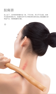 赤峰刮痧上門(mén)服務(wù)電話(huà)號(hào)碼是多少-第1張圖片