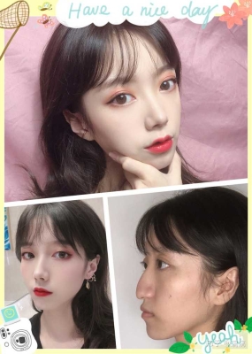 赤峰方赫微整形醫(yī)院電話號(hào)碼-第1張圖片