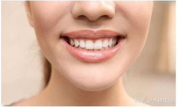 赤峰忠冠口腔醫(yī)院電話地址查詢-第1張圖片