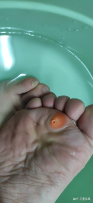 赤峰市修雞眼電話是多少號-第1張圖片