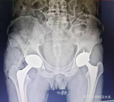 赤峰平民醫(yī)院馮大夫電話號碼-第1張圖片