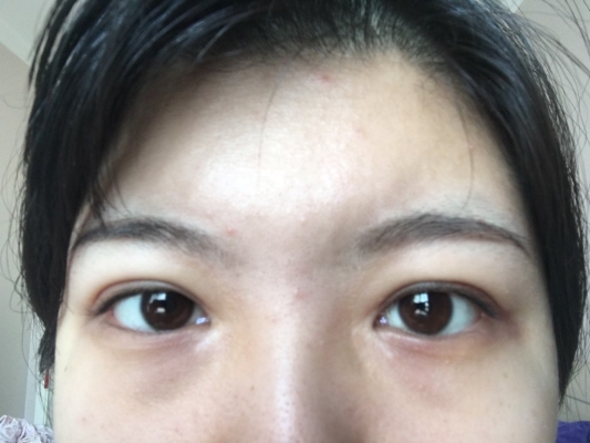 赤峰開眼角醫(yī)生電話號(hào)碼是多少-第1張圖片