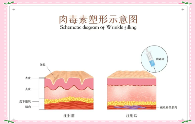 赤峰肉毒團(tuán)購(gòu)電話地址查詢-第1張圖片