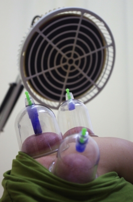 赤峰市中醫(yī)針灸診所電話號碼-第1張圖片