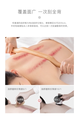 赤峰刮痧團(tuán)購(gòu)電話號(hào)碼-第1張圖片