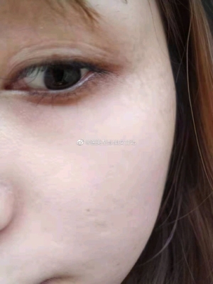 赤峰針劑醫(yī)美培訓(xùn)學(xué)校電話號(hào)碼-第1張圖片