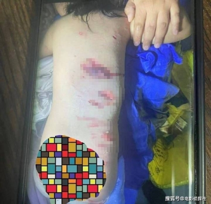 赤峰市狗咬傷醫(yī)院電話號碼-第1張圖片