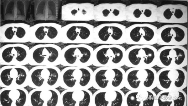 赤峰腫瘤醫(yī)院舉報(bào)電話是多少-第1張圖片