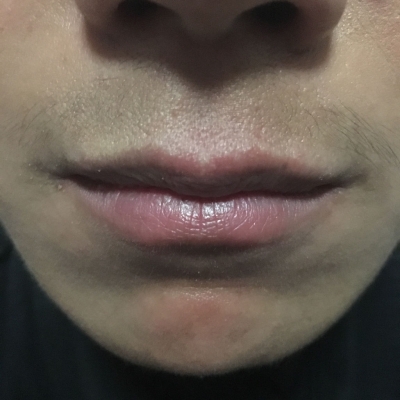 赤峰胡須清理中心地址電話號碼-第1張圖片