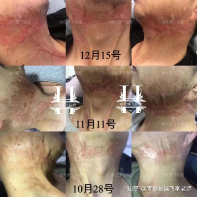 赤峰汽車地毯燙傷修復(fù)電話號碼-第1張圖片