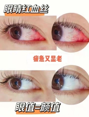 赤峰藍(lán)寶石醫(yī)美醫(yī)院電話號(hào)碼-第1張圖片