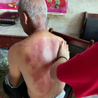 赤峰張家按摩店電話號(hào)碼多少-第1張圖片