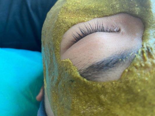 赤峰祛疣祛痘醫(yī)院電話號(hào)碼-第1張圖片