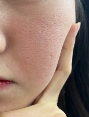 赤峰清潔毛孔團(tuán)購(gòu)地址電話號(hào)碼-第1張圖片